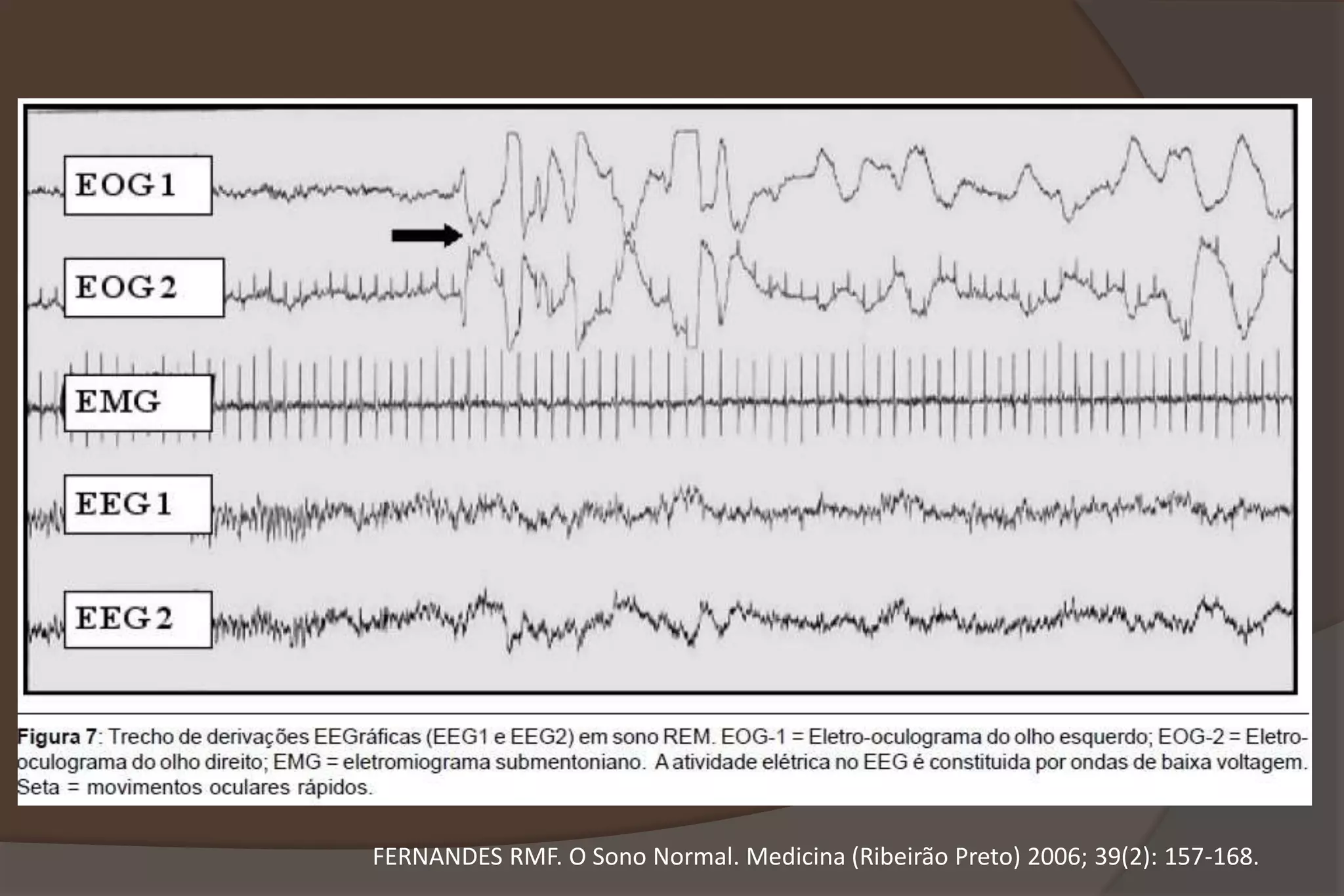 FERNANDES RMF. O Sono Normal. Medicina (Ribeirão Preto) 2006; 39(2): 157-168.
 