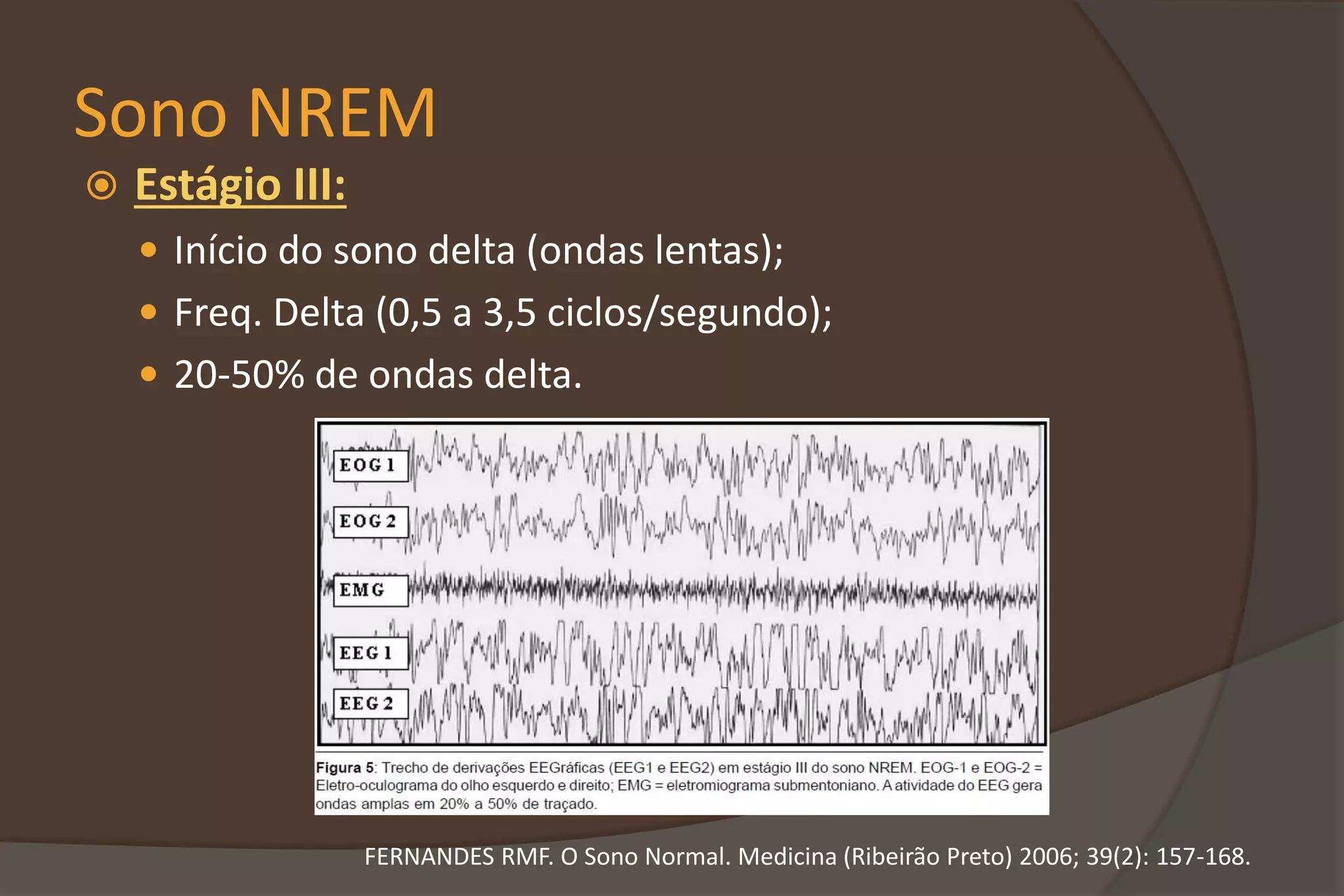 Sono NREM
 Estágio III:
 Início do sono delta (ondas lentas);
 Freq. Delta (0,5 a 3,5 ciclos/segundo);
 20-50% de ondas delta.
FERNANDES RMF. O Sono Normal. Medicina (Ribeirão Preto) 2006; 39(2): 157-168.
 