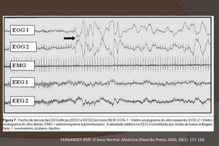 FERNANDES RMF. O Sono Normal. Medicina (Ribeirão Preto) 2006; 39(2): 157-168.
 