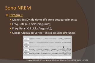 Sono NREM
 Estágio I:
 Menos de 50% de ritmo alfa até o desaparecimento;
 Freq. Teta (4-7 ciclos/segundo);
 Freq. Beta (>13 ciclos/segundo);
 Ondas Agudas do Vértex – início do sono profundo.
FERNANDES RMF. O Sono Normal. Medicina (Ribeirão Preto) 2006; 39(2): 157-168.
 