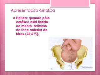 Apresentação cefálica
 Fletida: quando pólo
cefálico está fletido
ao mento, próximo
da face anterior do
tórax (95,5 %).
 