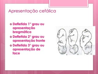 Apresentação cefálica
 Defletida 1° grau ou
apresentação
bregmática
 Defletida 2° grau ou
apresentação fronte
 Defletida 3° grau ou
apresentação de
face
 