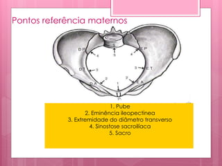1. Pube
2. Eminência ileopectínea
3. Extremidade do diâmetro transverso
4. Sinostose sacroilíaca
5. Sacro
Pontos referência maternos
 