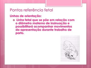 Pontos referência fetal
Linhas de orientação:
 Linha fetal que se põe em relação com
o diâmetro materno de insinuação e
possibilitará acompanhar movimentos
da apresentação durante trabalho de
parto.
 
