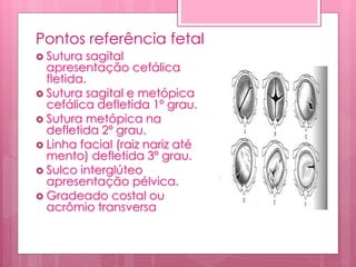 Pontos referência fetal
 Sutura sagital
apresentação cefálica
fletida.
 Sutura sagital e metópica
cefálica defletida 1º grau.
 Sutura metópica na
defletida 2º grau.
 Linha facial (raiz nariz até
mento) defletida 3º grau.
 Sulco interglúteo
apresentação pélvica.
 Gradeado costal ou
acrômio transversa
 