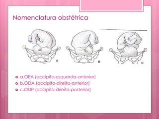 Nomenclatura obstétrica
 a.OEA (occípito-esquerda-anterior)
 b.ODA (occípito-direita-anterior)
 c.ODP (occípito-direita-posterior)
 