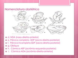 Nomenclatura obstétrica
 d. NDA (naso-direita-anterior)
 e. Pélvica completa –SDP (sacro-direita-posterior)
 f. Pélvica incompleta SDP (sacro-direita-posterior)
 g. Oblíqua
 h. Córmica AEP (acrômio-esquerda-posterior)
 i. Córmica ADA (acrômio-direita-anterior)
 