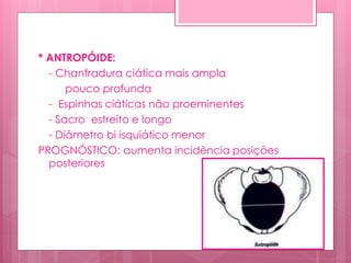 * ANTROPÓIDE:
- Chanfradura ciática mais ampla
pouco profunda
- Espinhas ciáticas não proeminentes
- Sacro estreito e longo
- Diâmetro bi isquiático menor
PROGNÓSTICO: aumenta incidência posições
posteriores
 