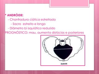 * ANDRÓIDE:
- Chanfradura ciática estreitada
- Sacro estreito e longo
- Diâmetro bi isquiático reduzido
PROGNÓSTICO: mau, aumenta distócias e posteriores
 