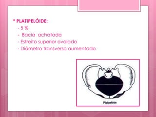 * PLATIPELÓIDE:
- 5 %
- Bacia achatada
- Estreito superior ovalado
- Diâmetro transverso aumentado
 