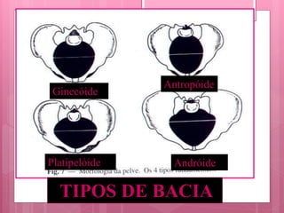TIPOS DE BACIA
Platipelóide Andróide
Antropóide
Ginecóide
 