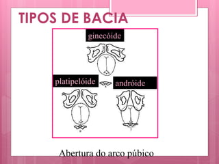 TIPOS DE BACIA
Abertura do arco púbico
ginecóide
andróideplatipelóide
 