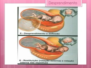 Desprendimento
 