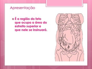 Apresentação
 É a região do feto
que ocupa a área do
estreito superior e
que nele se insinuará.
 