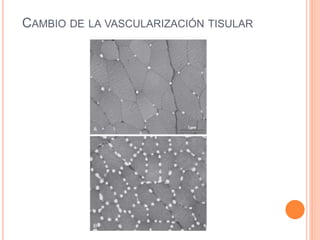 CAMBIO DE LA VASCULARIZACIÓN TISULAR
 