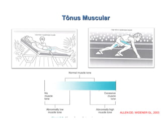 Tônus MuscularTônus Muscular
ALLEN DD, WIDENER GL, 2003
 