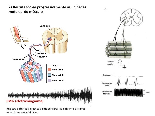 Eletromiograma