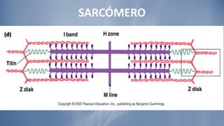 SARCÓMERO 