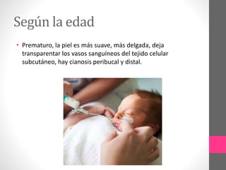 Según la edad
• Prematuro, la piel es más suave, más delgada, deja
transparentar los vasos sanguíneos del tejido celular
subcutáneo, hay cianosis peribucal y distal.
 
