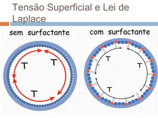 Tensão Superficial e Lei de 
Laplace 
 
