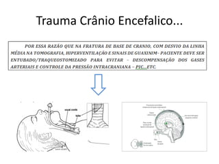 Trauma Crânio Encefalico...
 