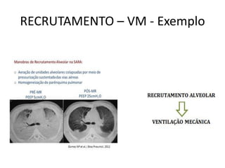 RECRUTAMENTO – VM - Exemplo
 