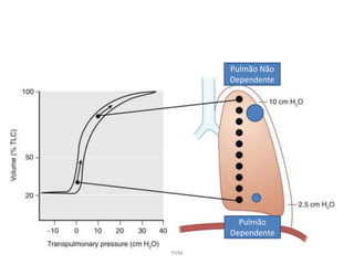 Fisiologia do Tórax
Pulmão
Dependente
Pulmão Não
Dependente
PVM
 