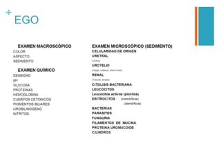 +
EGO
 
