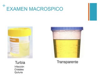 +
EXAMEN MACROSPICO
 