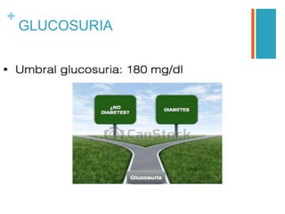 +
GLUCOSURIA
 
