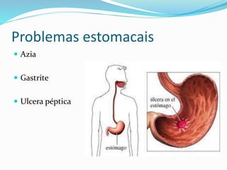 Problemas estomacais 
 Azia 
 Gastrite 
 Ulcera péptica 
 