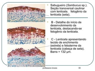 professora Ionara 55
 Sabugueiro (Sambucus sp.).
Seção transversal caulinar
com lenticela. felogênio da
lenticela (seta).
 B - Detalhe do início de
desenvolvimento da
lenticela, destacando-se
felogênio da lenticela.
 C - Lenticela apresentando
tecido de enchimento
(estrela) e feloderme da
lenticela (cabeça de seta).
Barra = 132 µm.
 
