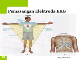 Pemasangan Elektroda EKG




18                       Faal_KV/ikun/2006
 