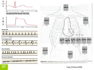 21   Faal_KV/ikun/2006
 