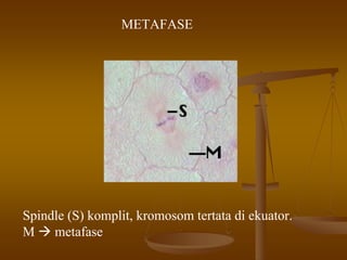 METAFASE
Spindle (S) komplit, kromosom tertata di ekuator.
M metafase
 