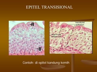 EPITEL TRANSISIONAL
Contoh: di epitel kandung kemih
 