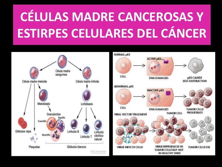 Cuanto Tarda En Desarrollarse Un Cáncer De Páncreas