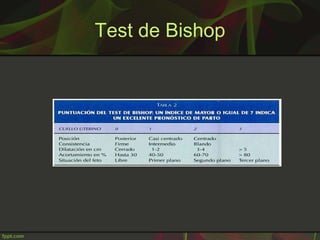 Test de Bishop
 