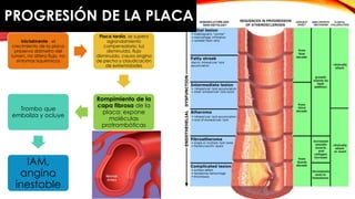 PROGRESIÓN DE LA PLACA 
Inicialmente , el 
crecimiento de la placa 
preserva diámetro del 
lumen, no altera flujo, no 
síntomas isquémicos 
Placa tardía, se supera 
agrandamiento 
compensatorio; luz 
disminuída, flujo 
disminuido, causa angina 
de pecho y claudicación 
de extremidades 
Rompimiento de la 
capa fibrosa de la 
placa: expone 
moléculas 
protrombóticas 
Trombo que 
emboliza y ocluye 
IAM, 
angina 
inestable 
 