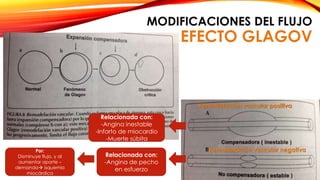 MODIFICACIONES DEL FLUJO 
EFECTO GLAGOV 
Remodelación vascular positiva 
Remodelación vascular negativa 
Relacionada con: 
-Angina inestable 
-Infarto de miocardio 
-Muerte súbita 
Relacionada con: 
-Angina de pecho 
en esfuerzo 
Por: 
Disminuye flujo, y al 
aumentar aporte – 
demanda isquemia 
miocárdica 
 