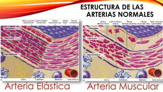 ESTRUCTURA DE LAS 
ARTERIAS NORMALES 
Arteria Elástica Arteria Muscular 
 