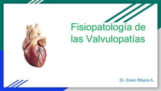 Dr. Erwin Ribera A.
Fisiopatología de
las Valvulopatías
 