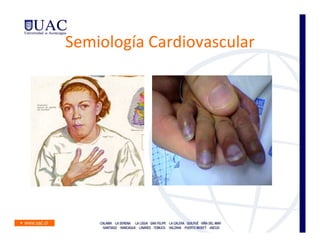 Semiología Cardiovascular
 