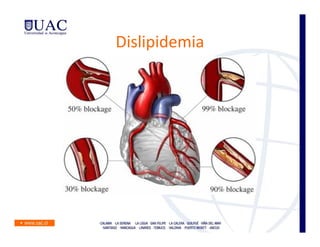 Dislipidemia
 