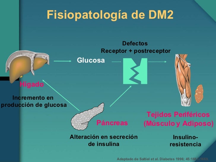 Fisiopatologia Diabetes Mellitus 2