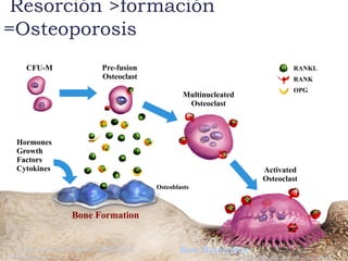 Resorción >formación
=Osteoporosis
Activated
Osteoclast
CFU-M Pre-fusion
Osteoclast
Multinucleated
Osteoclast
Provided as an educational resource. Do not copy or distribute.© 2007 Amgen. All rights reserved.
Osteoblasts
Bone Formation
Bone ResorptionAdapted from: Boyle WJ, et al. Nature. 2003;423:337-342.
Hormones
Growth
Factors
Cytokines
RANKL
RANK
OPG
 