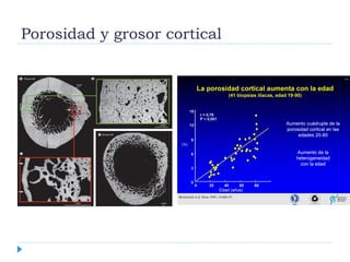 Porosidad y grosor cortical
 