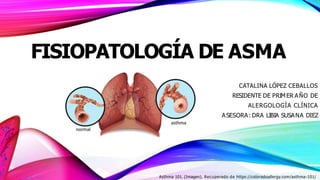 FISIOPATOLOGÍA DE ASMA
CATALINA LÓPEZ CEBALLOS
RESIDENTE DE PRIMER AÑO DE
ALERGOLOGÍA CLÍNICA
ASESORA: DRA LIBIA SUSANA DIEZ
Asthma 101. (Imagen). Recuperado de https://coloradoallergy.com/asthma-101/
 