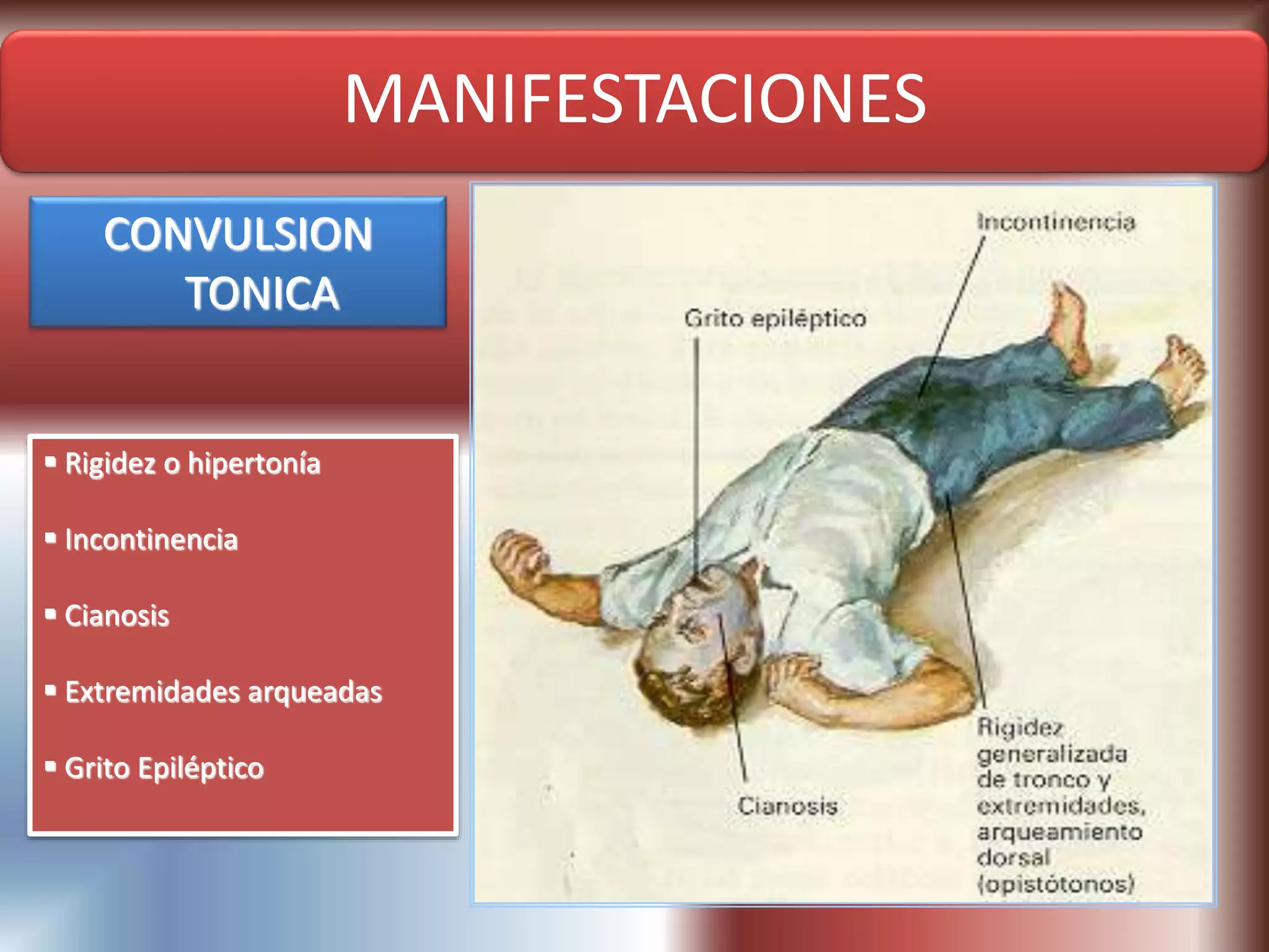 Fisiopatologia convulsiones y epilepsias | PPT