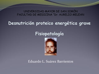 Desnutrición proteico energética grave
Fisiopatología
Eduardo L. Suárez Barrientos
UNIVERSIDAD MAYOR DE SAN SIMÓN
FACULTAD DE MEDICINA “Dr. AURELIO MELEAN
 